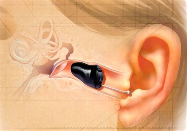 The 5 Best Invisible Hearing Aids (Latest Edition)