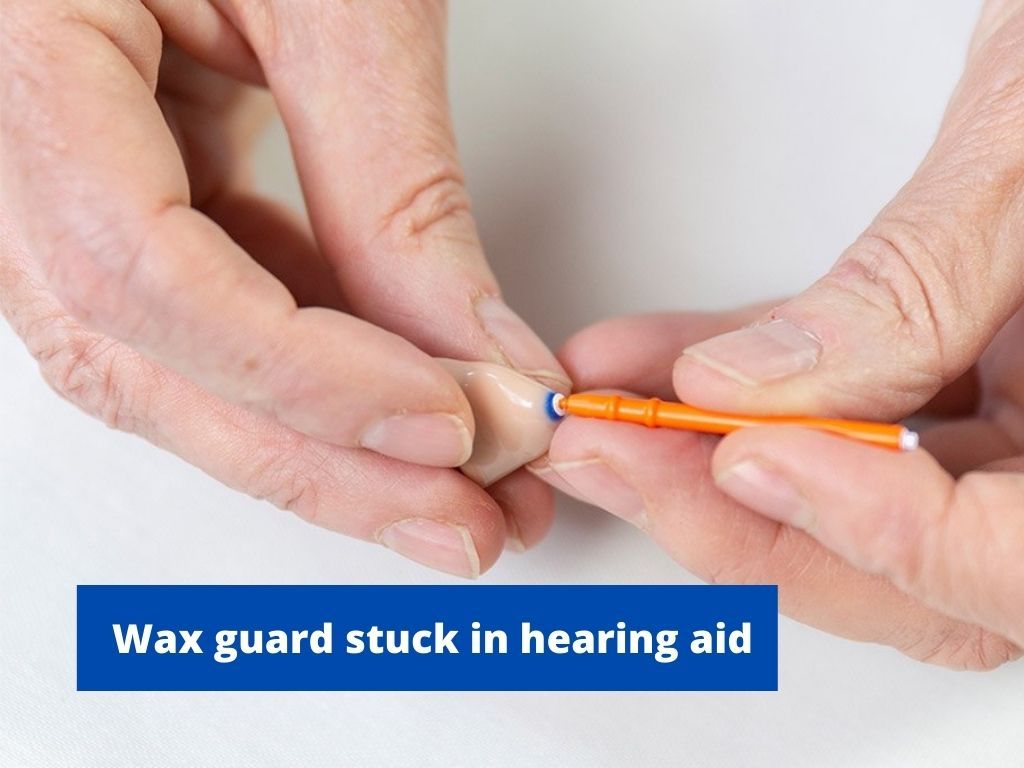 5 Easy Steps to Remove Wax Guard Stuck in Hearing Aid