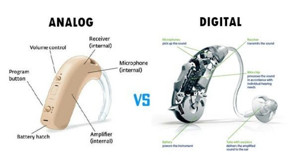 Analog vs. Digital Hearing Aids: What’s the Difference?